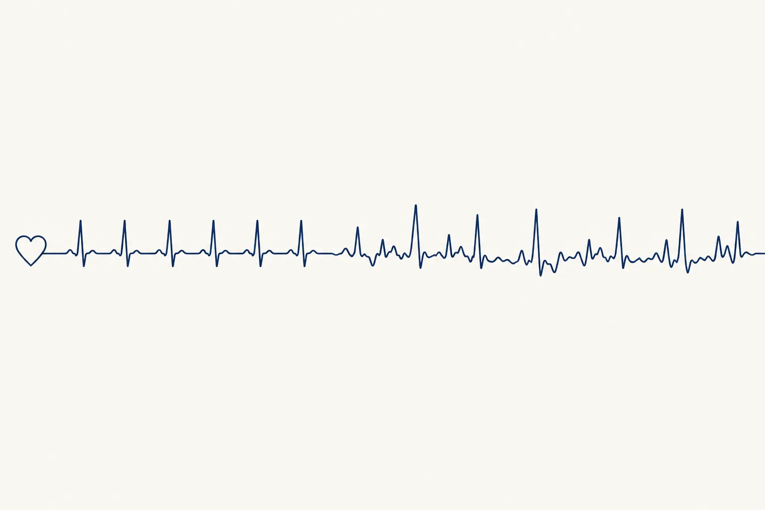 A single navy ECG trace on cream that starts regular and becomes irregular, with a small heart outline where it begins